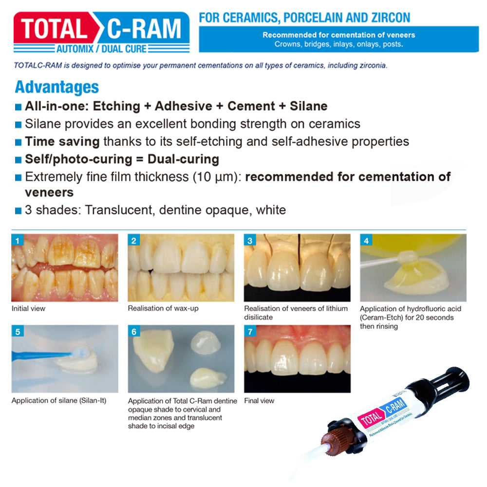 Dentistry Material Itena Total C Ram Permanent Dental Cement For Veneer Ceramic Teeth Crown Resin Self Totalcem Adhesive Dual Cure