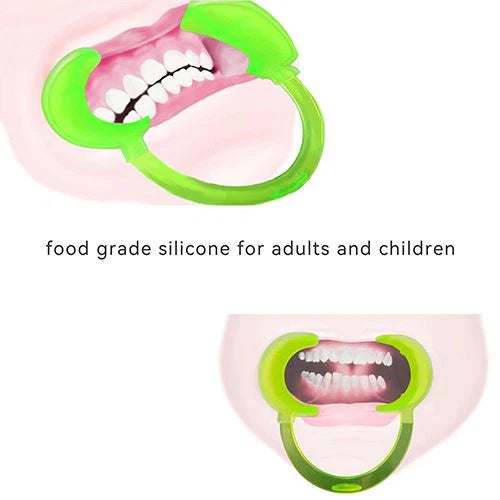 Dental Cheek Lip Retractor